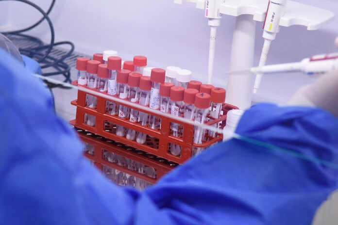 ÚVN v Ruomberku zaèala s testovaním vzoriek na COVID-19