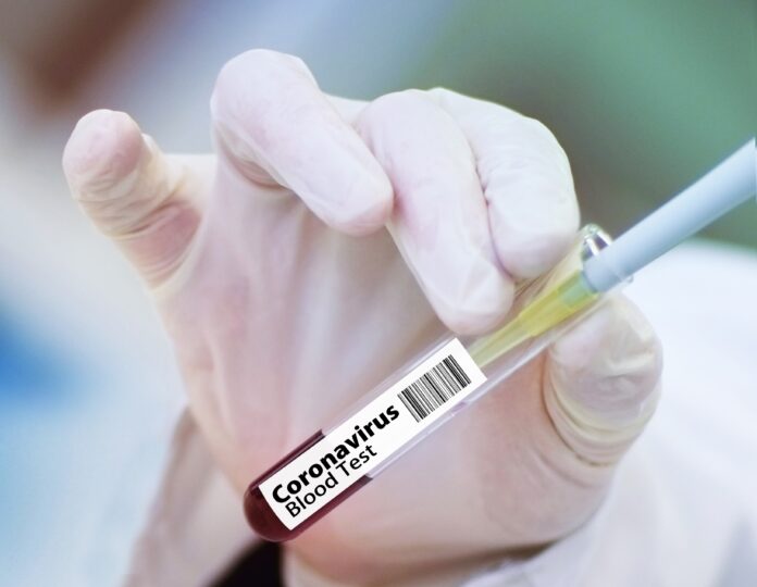 vaccine-chemist-outbreak-stockpack-pixabay.jpg vaccine, chemist, outbrea, vakcína, koronavírusk