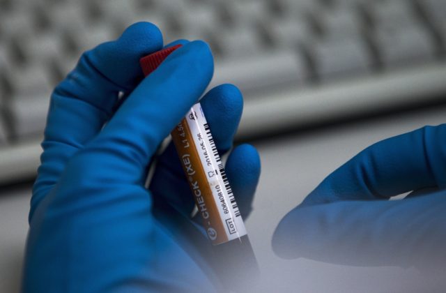 WADA odobrala licenciu moskovskému antidopingovému laboratóriu