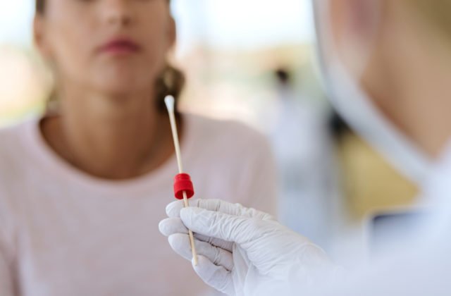 Firmy majú poslednú možnosť požiadať o preplatenie nákladov na povinné testovanie zamestnancov