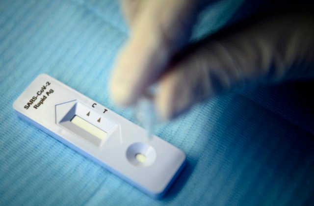 Zamestnávatelia môžu o preplatenie nákladov na povinné testovanie zamestnancov žiadať do konca marca