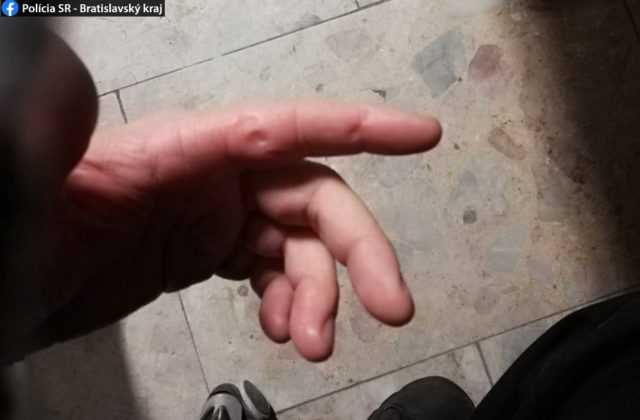 Opitý muž v Bratislave napadol policajtov