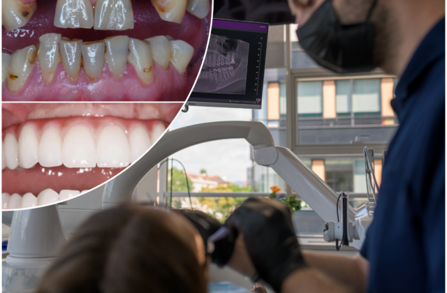 Zubné implantáty zmenia život